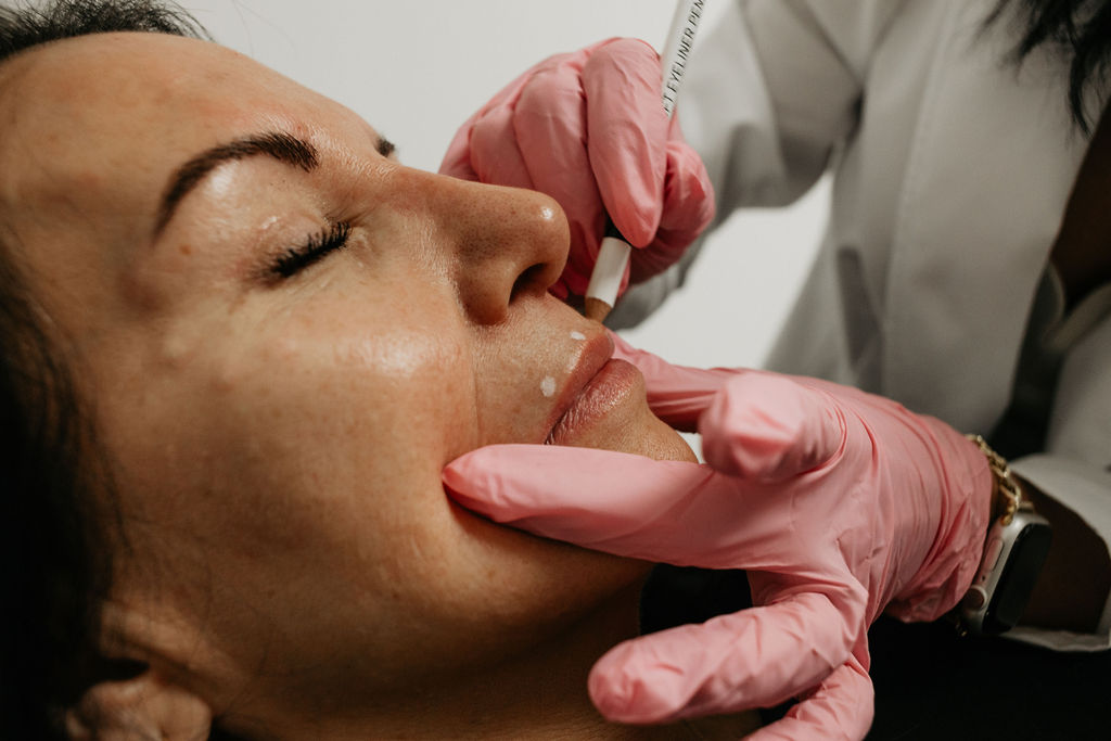 Restylane
